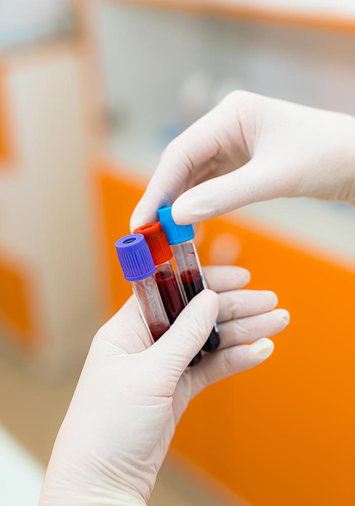 provette di esami del sangue
